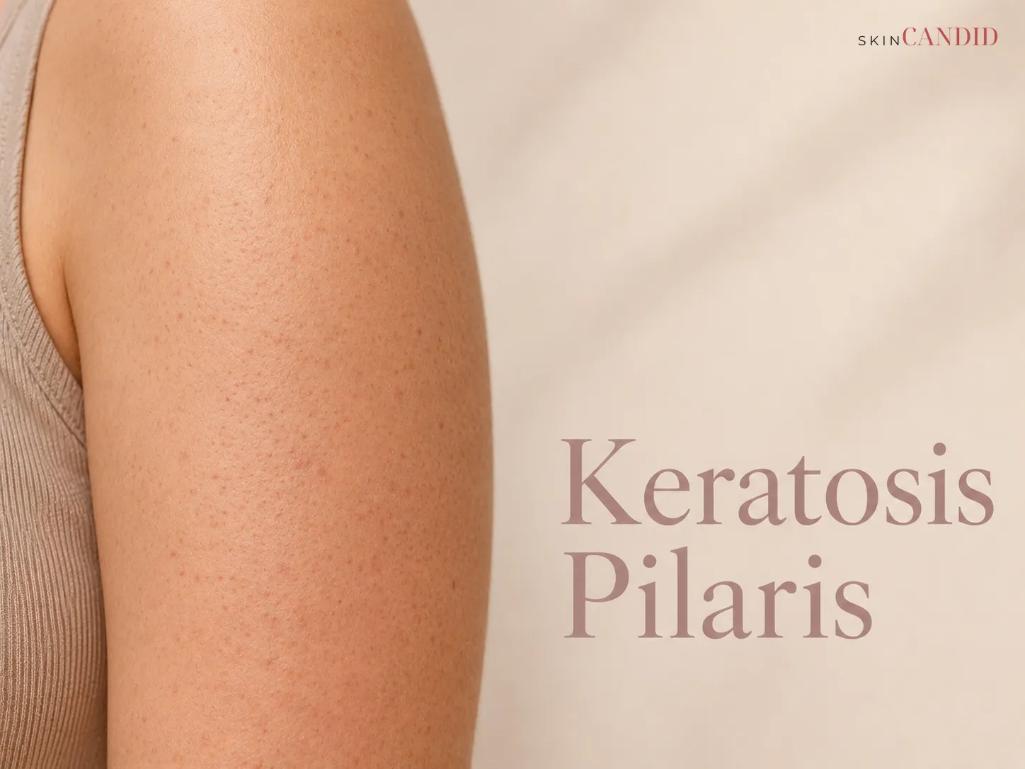 Close-up of an upper arm with small rough follicular bumps and mild surrounding redness.